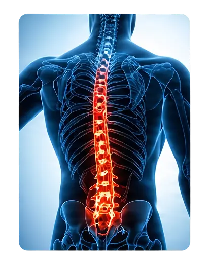 Lesiones de espalda